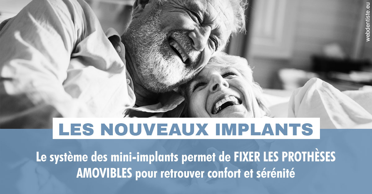 https://dr-levi-ted.chirurgiens-dentistes.fr/Les nouveaux implants 2