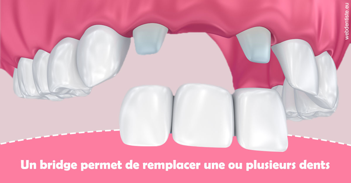 https://dr-levi-ted.chirurgiens-dentistes.fr/Bridge remplacer dents 2