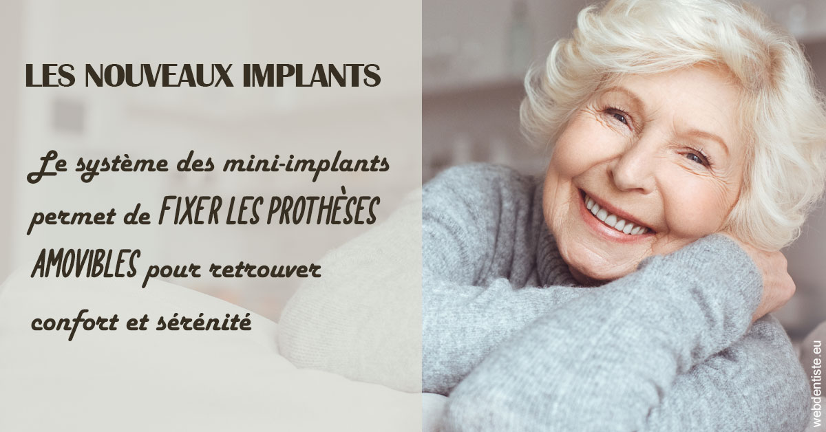 https://dr-levi-ted.chirurgiens-dentistes.fr/Les nouveaux implants 1