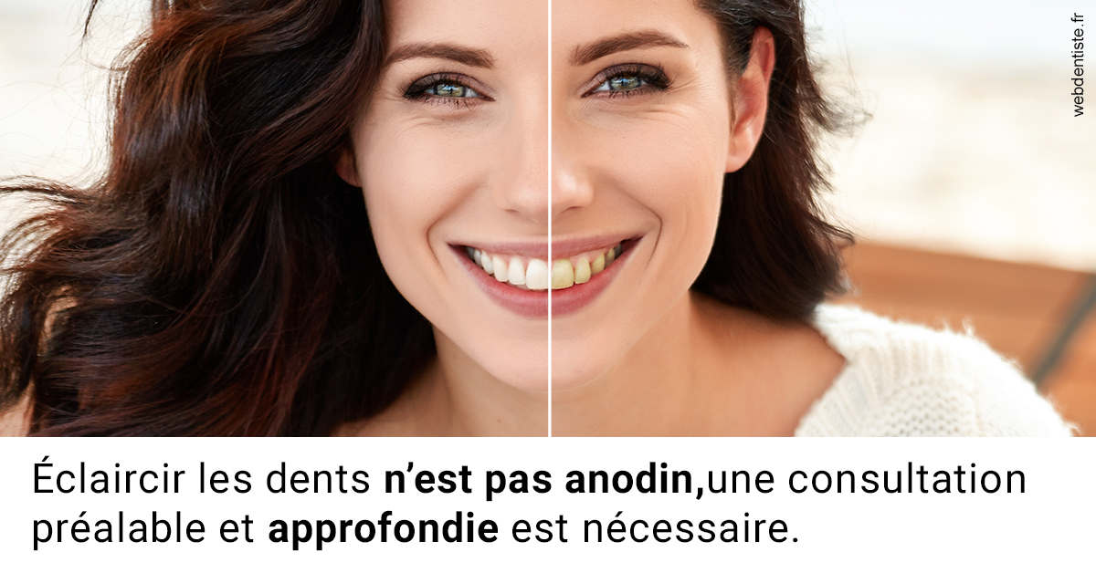 https://dr-levi-ted.chirurgiens-dentistes.fr/Le blanchiment 2