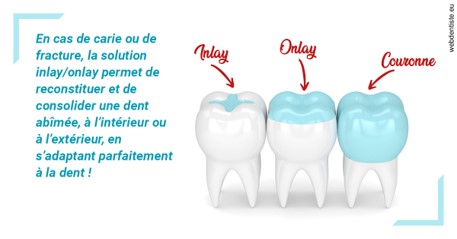 https://dr-levi-ted.chirurgiens-dentistes.fr/L'INLAY ou l'ONLAY