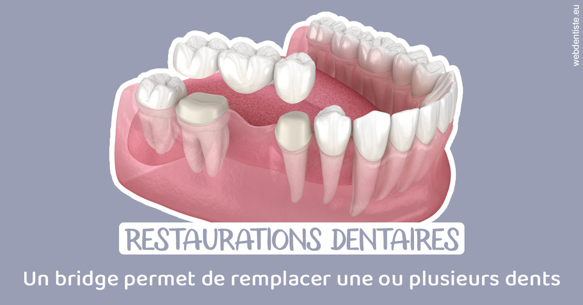 https://dr-levi-ted.chirurgiens-dentistes.fr/Bridge remplacer dents 1