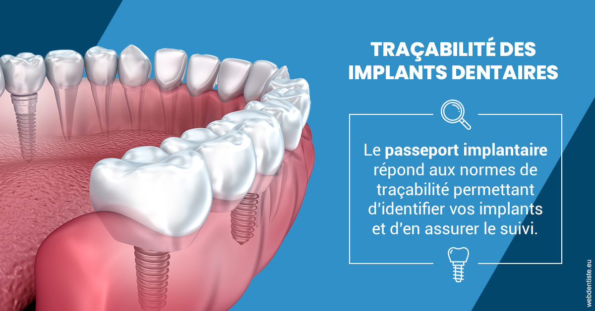 https://dr-levi-ted.chirurgiens-dentistes.fr/T2 2023 - Traçabilité des implants 1