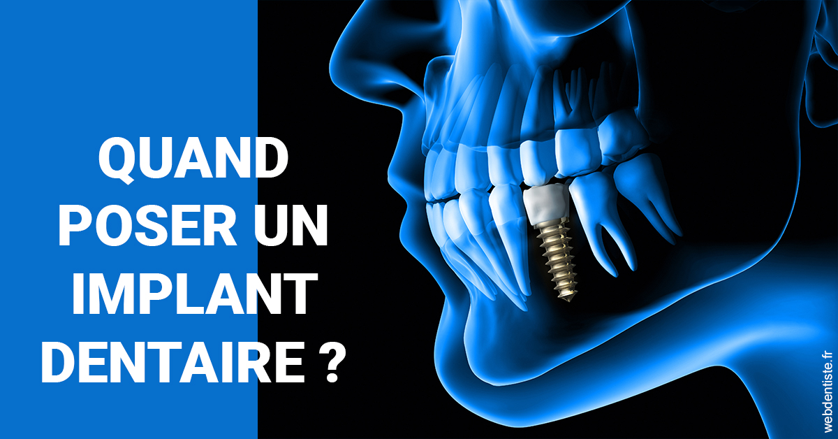 https://dr-levi-ted.chirurgiens-dentistes.fr/Les implants 1
