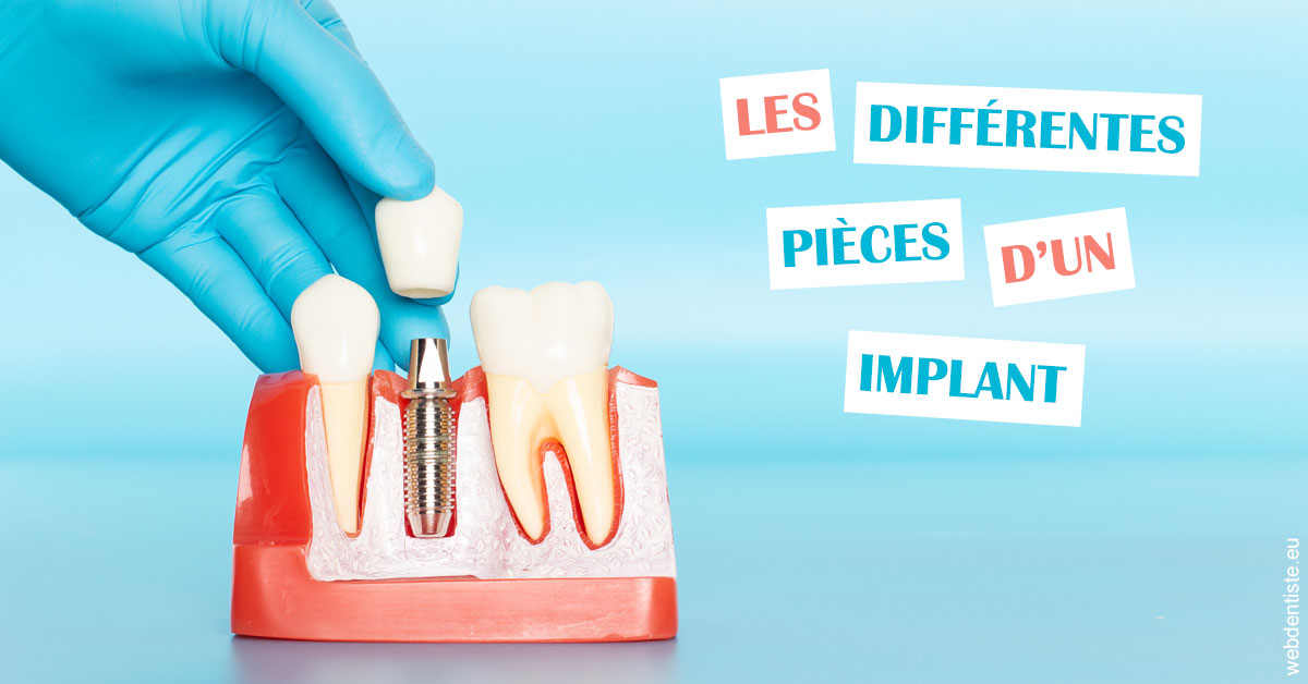 https://dr-levi-ted.chirurgiens-dentistes.fr/Les différentes pièces d’un implant 2