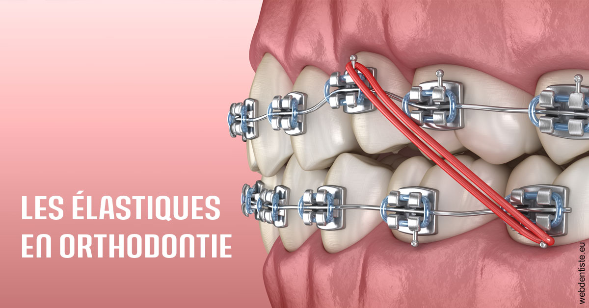 https://dr-levi-ted.chirurgiens-dentistes.fr/Elastiques orthodontie 2