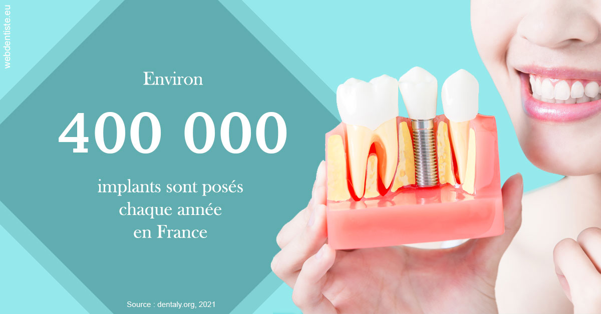 https://dr-levi-ted.chirurgiens-dentistes.fr/Pose d'implants en France 2